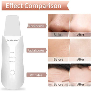 Skin Scrubber